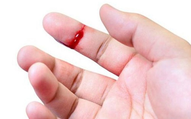 Mơ thấy bị chảy máu ở tay là điềm báo gì Mơ thấy bị chảy máu ở tay là điềm báo gì