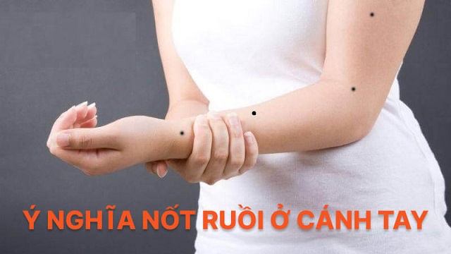 Ý nghĩa của 2 nốt ruồi song song Ý nghĩa của 2 nốt ruồi song song